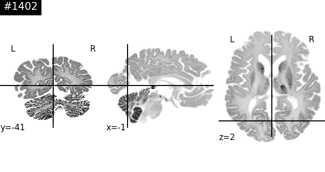 004 access bigbrain