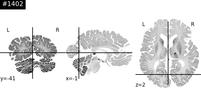004 access bigbrain